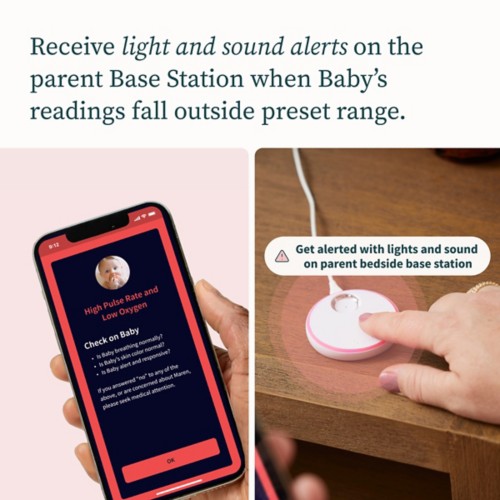 Owlet Dream Sock Baby Monitor - Primary Image