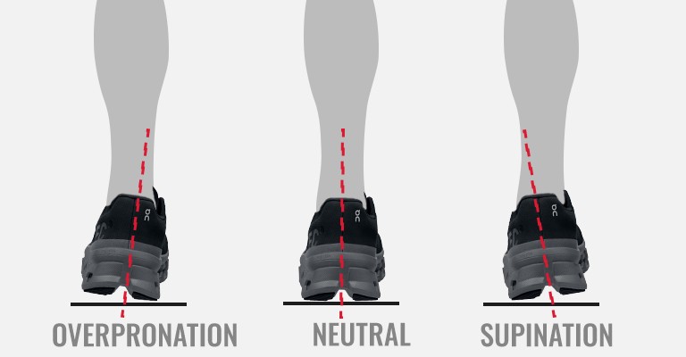 overpronation neutral and supination graphic